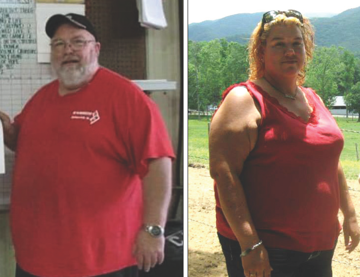 Dwayne and Allenna Lingers before bariatric surgery