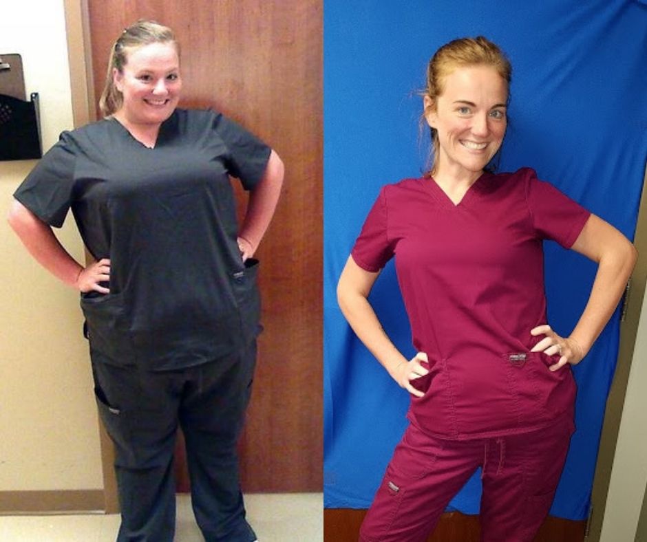 Whitney Copeland before and after bariatric surgery