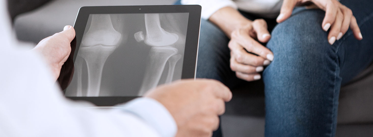 physician looking at knee x-ray with patient