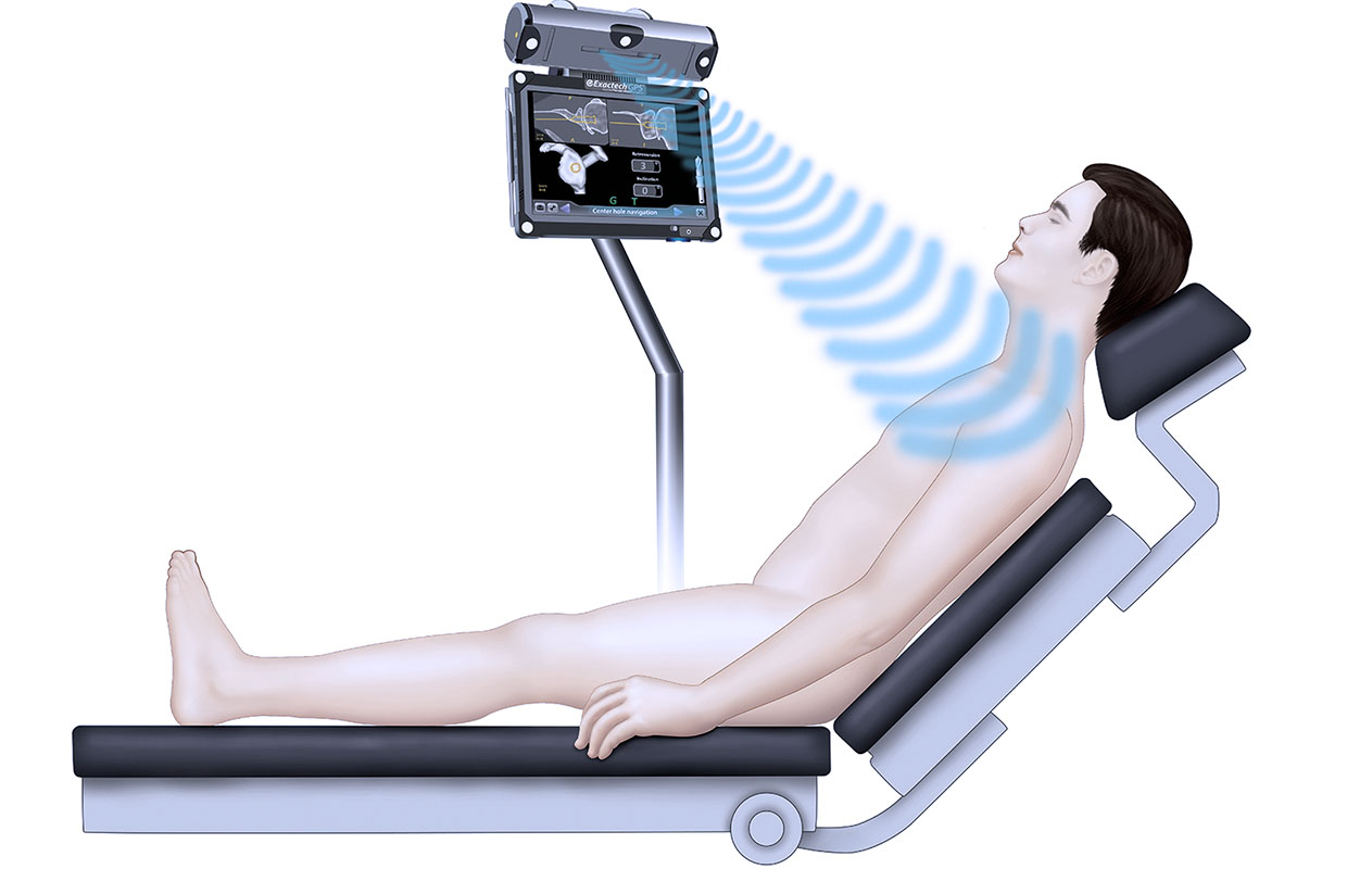 graphic of GPS equipment scanning shoulder for shoulder replacement
