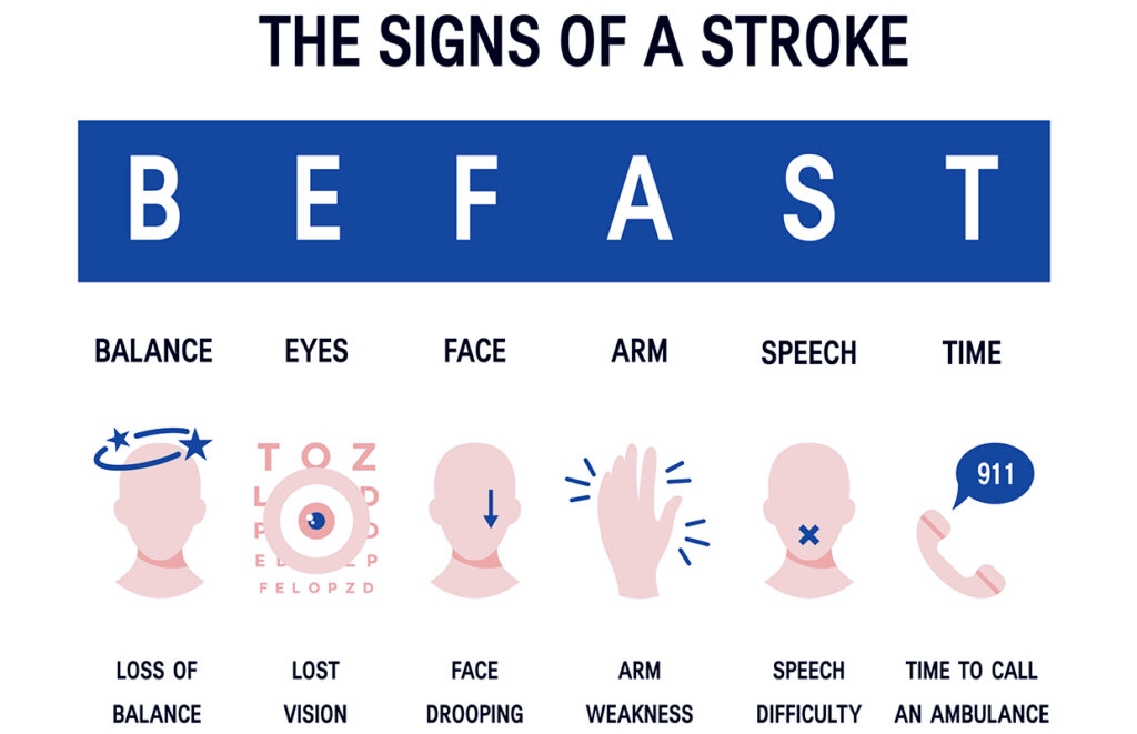 Infographic titled “The Signs of a Stroke” with the acronym BEFAST: Balance loss, Eyes—lost vision, Face drooping, Arm weakness, Speech difficulty, and Time to call an ambulance (911). Includes matching icons and stroke info from Cumberland Medical Center.