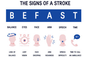 graphic of befast stroke symptoms