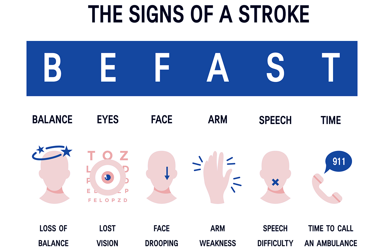 graphic of befast stroke symptoms