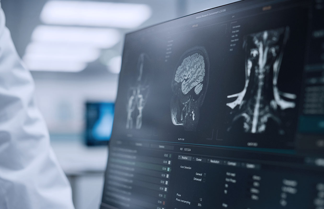 doctor looking at a scan on a computer screen