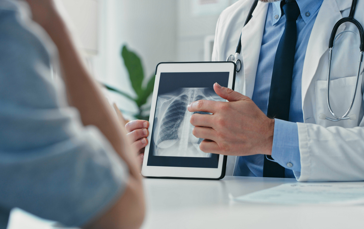 Doctor showing patient x-ray of lungs on a tablet