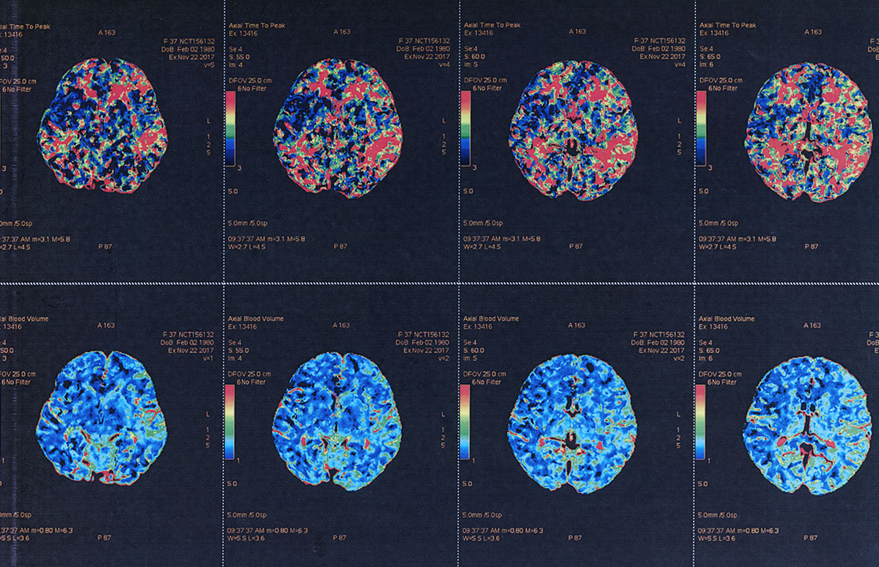 digital image showing different view or images of an brain mri