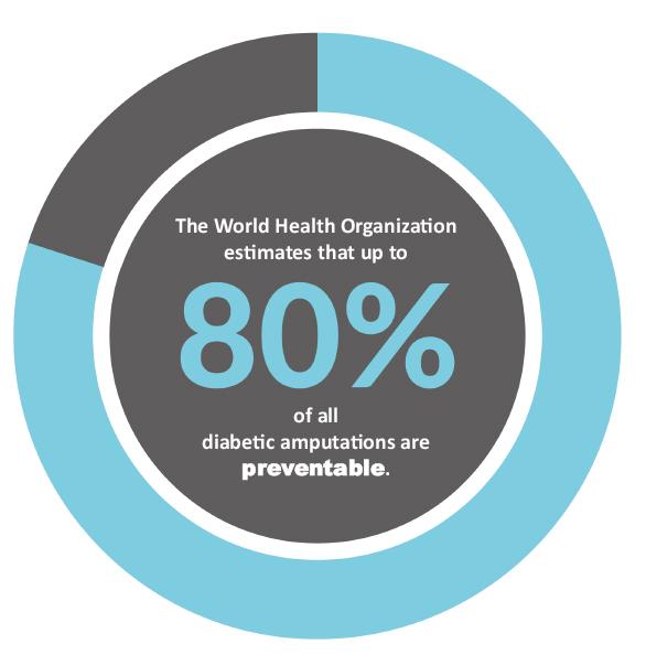 The World Health Organization estimates that up to 80 percent of all diabetic amputations are preventable.