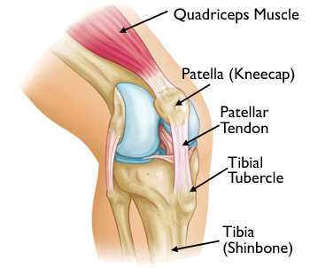 Osgood-Schlatter Disease