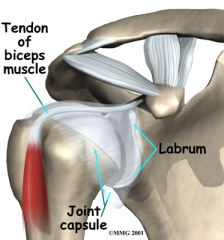 icd 10 code for left shoulder glenoid labrum tear