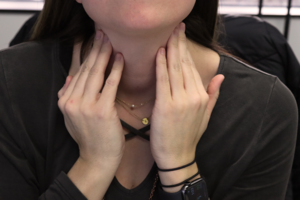 Vagus Nerve Stimulation