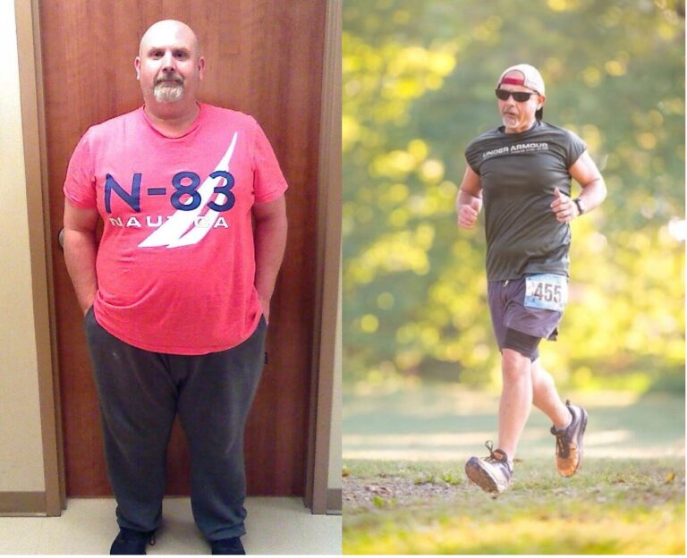 Before and After Photo of Wil Nelson