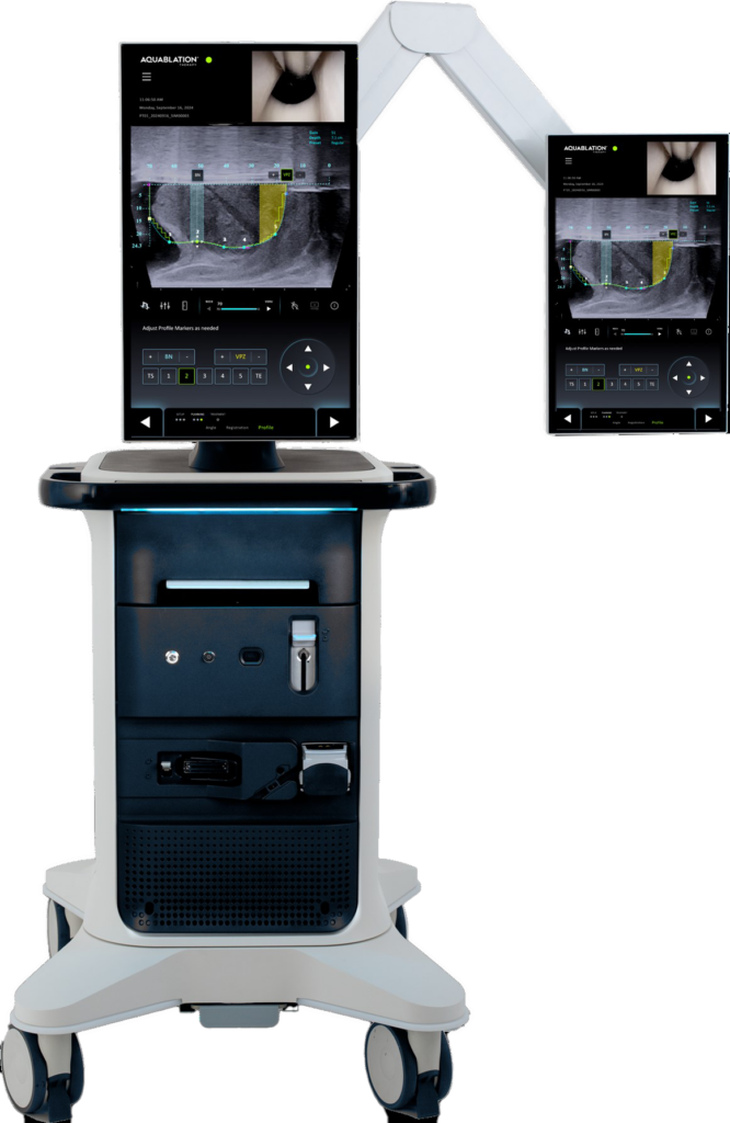 Photo of Cumberland Medical Center's new equipment for robotic-assisted treatment of enlarged prostates.