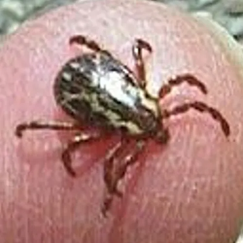 A close-up image of a tick with a brown and black patterned body crawling on human skin.