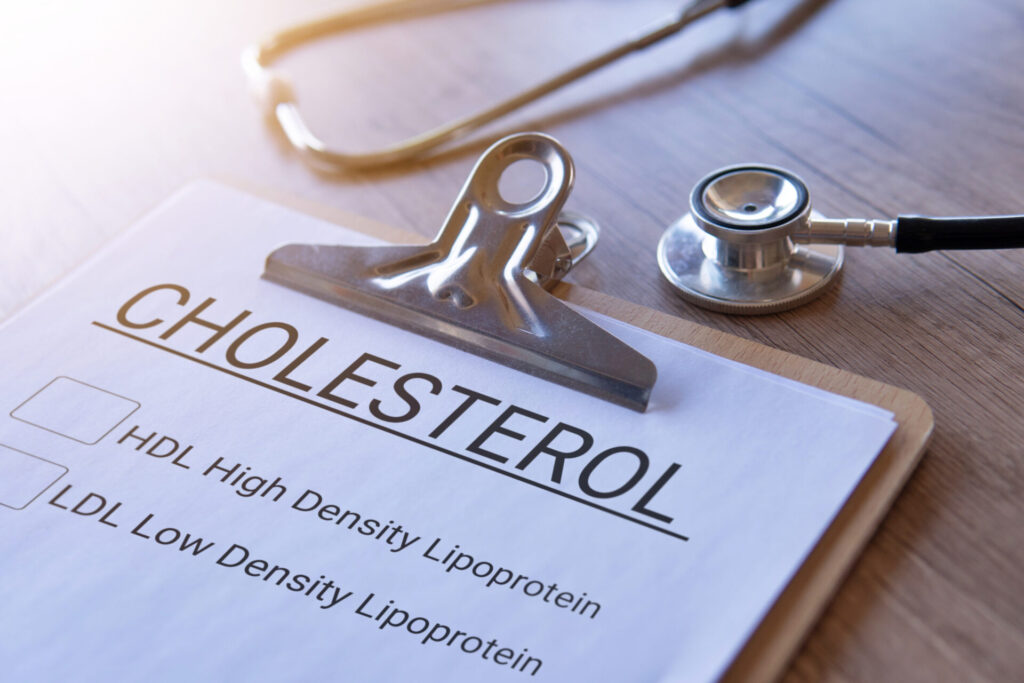 A clipboard with a cholesterol test form and a stethoscope on a wooden table. The form lists HDL (High Density Lipoprotein) and LDL (Low Density Lipoprotein) checkboxes.