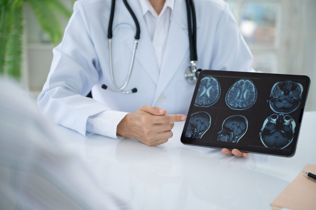 A doctor in a white coat points to brain MRI scans displayed on a tablet during a neurology consultation at a desk.